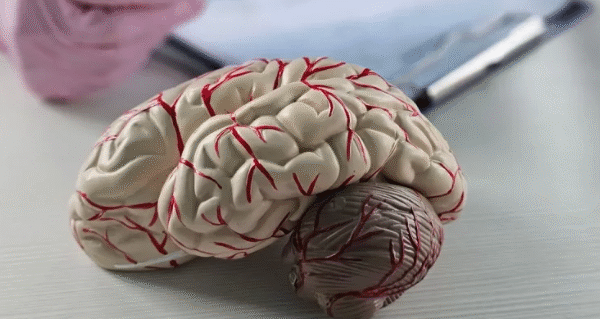 Brain Injury Lawyer: Seeking Compensation for Long-Term Recovery